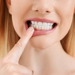 Zahnfleischbluten Zahnfleischentzündung - Behandlung Krems / Niederösterreich